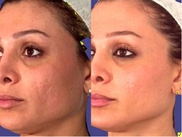 Cuidados faciales