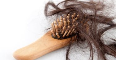 pérdida de cabello en las mujeres