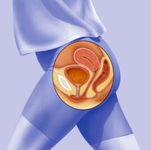 Cuidandonos de infecciones recurrentes