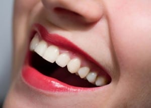 Estética dental