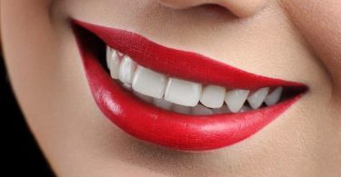 Sonrisa perfecta